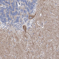 ANKRD16 Antibody, Novus Biologicals 0.1mL; Unlabeled:Antibodies, Polyclonal